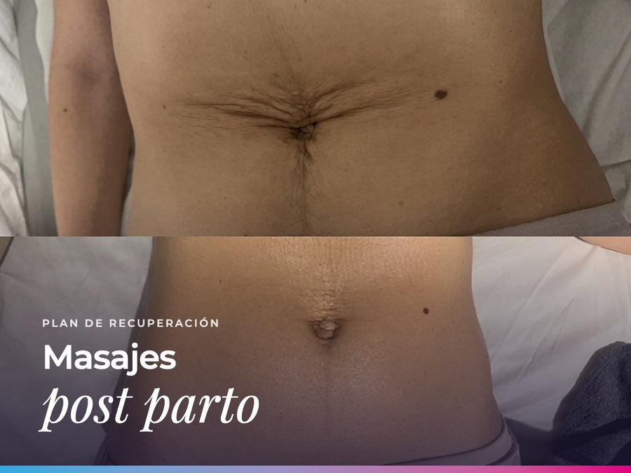 Masajes post parto en SOLER