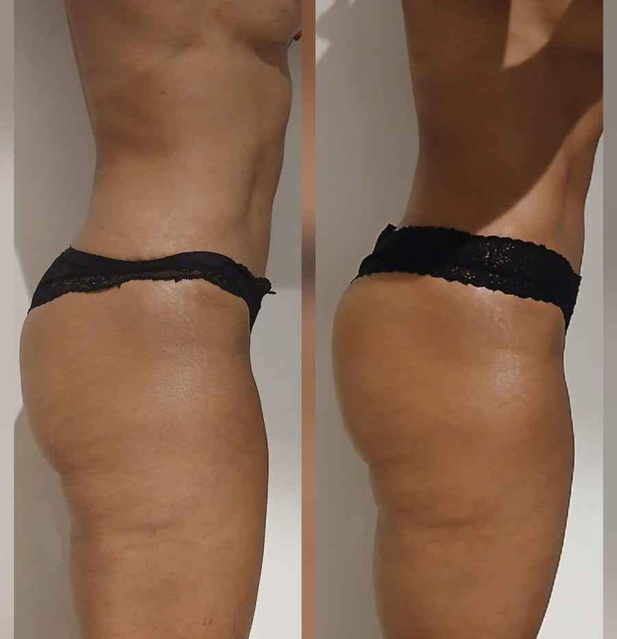 Antes y después Divine Body Detox SOLER